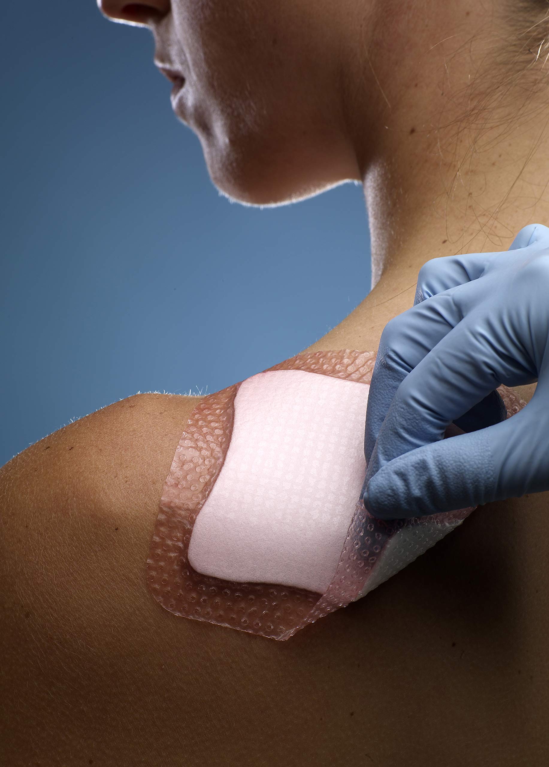 Smith & Nephew 99XX0367 Allevyn Gentle Border Dressing, 7.5cm x 7.5cm, Pack of 10